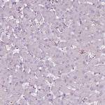 Calpain 9 Antibody in Immunohistochemistry (IHC)