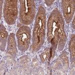 Calpain 9 Antibody in Immunohistochemistry (IHC)