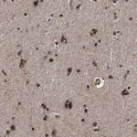 CAAP1 Antibody in Immunohistochemistry (Paraffin) (IHC (P))