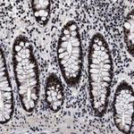 CAAP1 Antibody in Immunohistochemistry (Paraffin) (IHC (P))