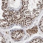 CAAP1 Antibody in Immunohistochemistry (Paraffin) (IHC (P))