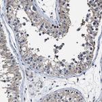 RSBN1L Antibody in Immunohistochemistry (IHC)