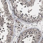 RSBN1L Antibody in Immunohistochemistry (IHC)