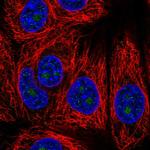 HDHD3 Polyclonal Antibody