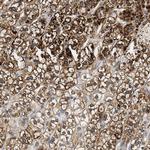 HDHD3 Antibody in Immunohistochemistry (IHC)
