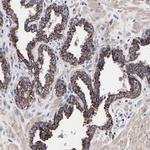 SHFM1 Antibody in Immunohistochemistry (Paraffin) (IHC (P))