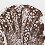 CLIP2 Polyclonal Antibody