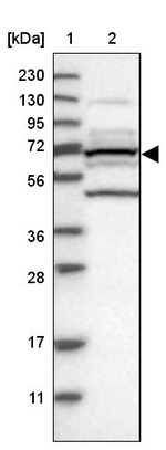 PLS3 Antibody in Western Blot (WB)