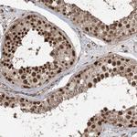 ZNF839 Antibody in Immunohistochemistry (Paraffin) (IHC (P))
