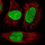 DRB1 Polyclonal Antibody