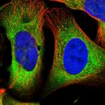 DARS Antibody in Immunocytochemistry (ICC/IF)