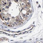 DARS Antibody in Immunohistochemistry (IHC)