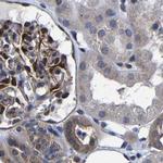 DARS Antibody in Immunohistochemistry (IHC)