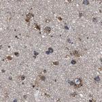 DARS Antibody in Immunohistochemistry (IHC)