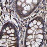 DARS Antibody in Immunohistochemistry (IHC)