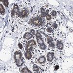 DARS Antibody in Immunohistochemistry (IHC)