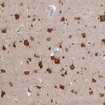 RASAL2 Polyclonal Antibody