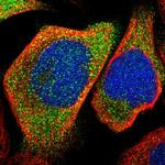 KLHDC1 Polyclonal Antibody