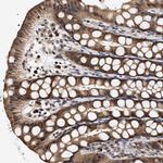 KLHDC1 Antibody in Immunohistochemistry (Paraffin) (IHC (P))