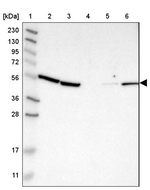 KLHDC1 Antibody in Western Blot (WB)
