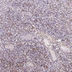 MUM1L1 Antibody in Immunohistochemistry (IHC)