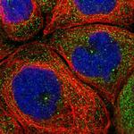 CNTRL Polyclonal Antibody