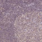 CNTRL Antibody in Immunohistochemistry (IHC)