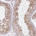 CNTRL Antibody in Immunohistochemistry (IHC)