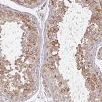CNTRL Antibody in Immunohistochemistry (IHC)