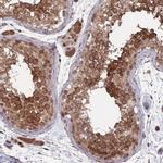 CNTRL Polyclonal Antibody