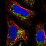 MALSU1 Polyclonal Antibody