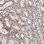 MALSU1 Antibody in Immunohistochemistry (Paraffin) (IHC (P))
