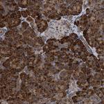 MALSU1 Antibody in Immunohistochemistry (Paraffin) (IHC (P))