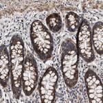 MALSU1 Antibody in Immunohistochemistry (Paraffin) (IHC (P))