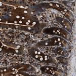 OSTF1 Antibody in Immunohistochemistry (Paraffin) (IHC (P))