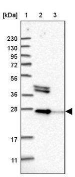 OSTF1 Antibody in Western Blot (WB)