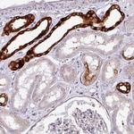 SCIN Polyclonal Antibody