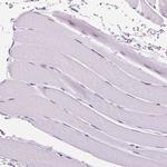AIF1L Antibody in Immunohistochemistry (IHC)