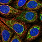 ACN9 Polyclonal Antibody