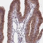 ACN9 Antibody in Immunohistochemistry (Paraffin) (IHC (P))