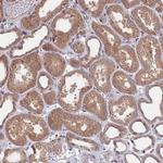 ACN9 Antibody in Immunohistochemistry (Paraffin) (IHC (P))