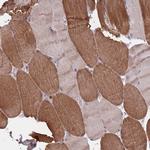 ACN9 Antibody in Immunohistochemistry (Paraffin) (IHC (P))