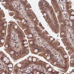 ACN9 Antibody in Immunohistochemistry (Paraffin) (IHC (P))