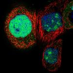 NSUN5 Polyclonal Antibody