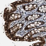 NSUN5 Antibody in Immunohistochemistry (Paraffin) (IHC (P))