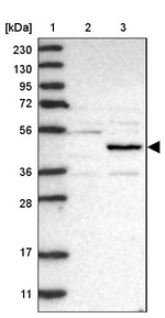NSUN5 Antibody in Western Blot (WB)