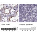 PRSS37 Antibody in Immunohistochemistry (IHC)