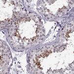 PRSS37 Antibody in Immunohistochemistry (IHC)