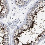 Ubiquilin 3 Antibody in Immunohistochemistry (IHC)