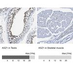 ASZ1 Antibody in Immunohistochemistry (IHC)